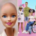 Omiljena lutkica: Barbie odsad dolazi s vitiligom i bez kose