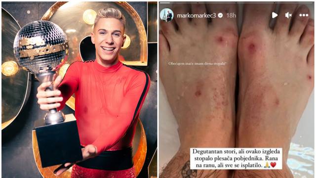 Marco Cuccurin pokazao rane od plesa: 'Sve mi se to isplatilo'