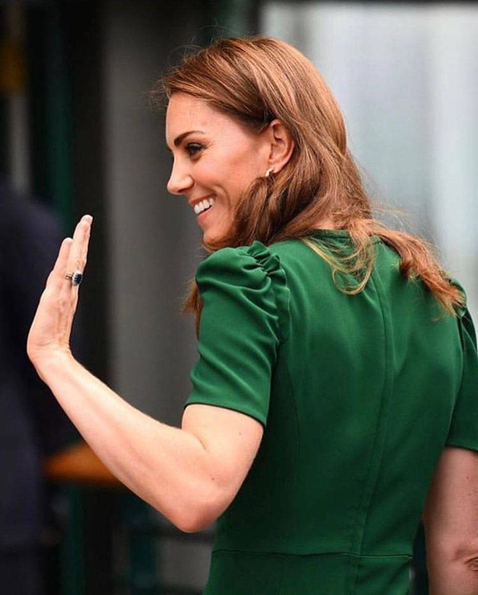 Kirurg tvrdi: Kate Middleton je bila na botoksu, sakrila je bore