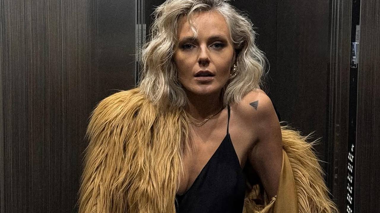 FOTO Ove slavne dame išle su pod nož: Neke su zablistale, drugima su zahvati uništili lice
