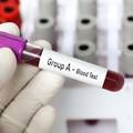 Krvna grupa otkriva osobnost: Jeste li perfekcionist, optimist, umjetni&ccaron;ka du&scaron;a ili egocentrik?