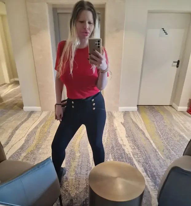 FOTO Žena s najvećim usnama na svijetu otkrila kako je nekoć izgledala: Šok! Bila si prekrasna