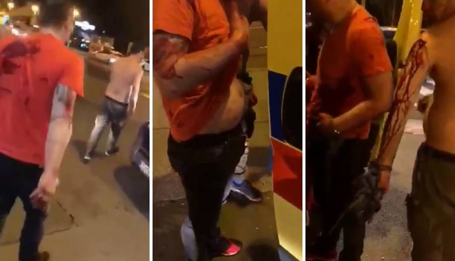 Krvave ruke, majice: 'Pomozite mi, ljudi, pa iskrvarit ću ovdje'