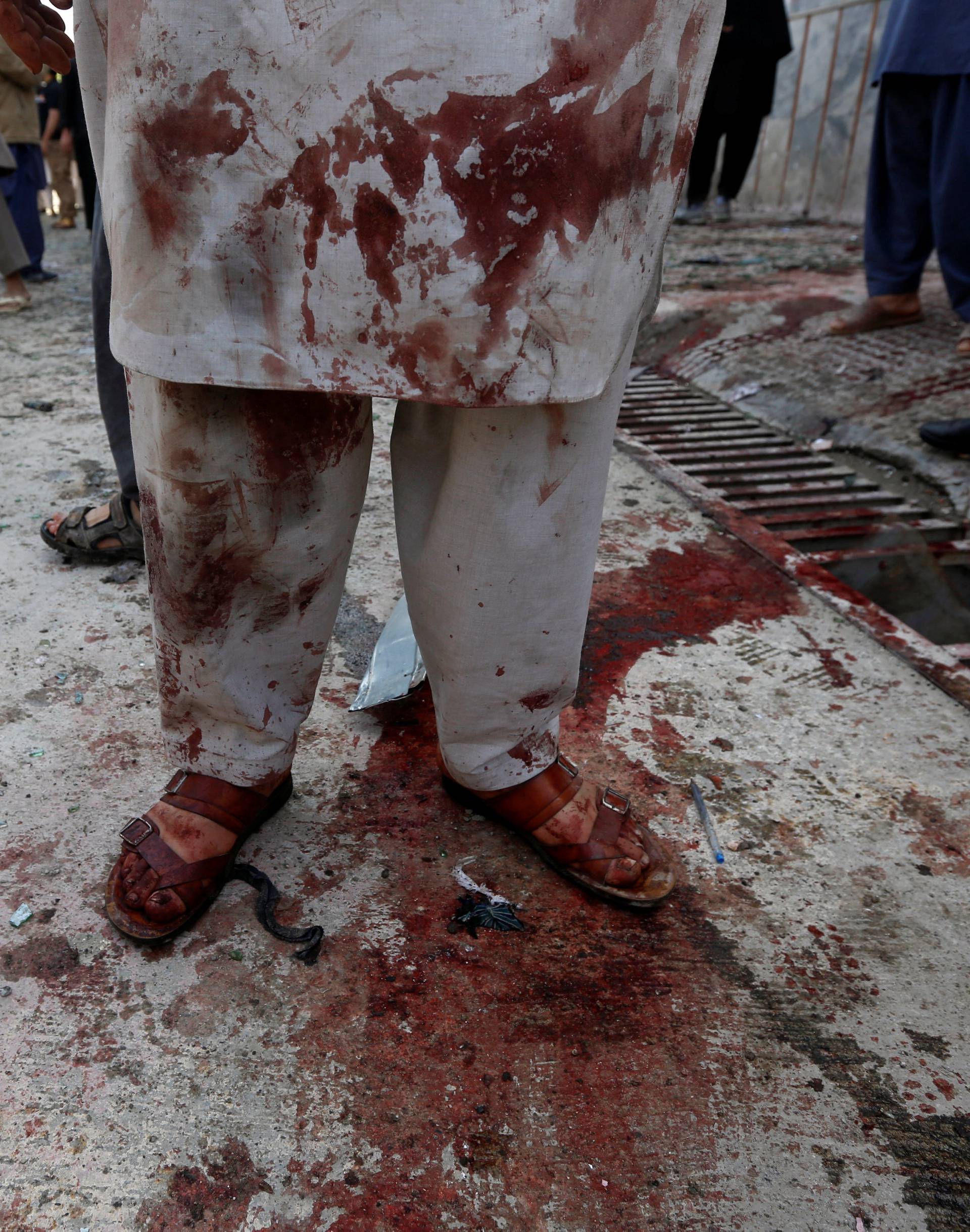 A man stained with blood inspects at the site of a suicide bomb attack in Kabul
