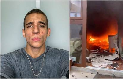 Glumcu iz serije 'La Casa de Papel' izgorjela kuća u požaru: 'Pobjegao sam kroz prozor...'