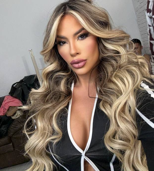 FOTO Nosi nadimak 'guza koja ometa'. Kaže da joj ne smeta: 'Sve prirodno. Nema silikona...'