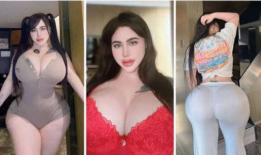 FOTO Mila želi ukloniti rebra zbog struka: 'Po dva sa svake strane da mi guza izgleda šire'