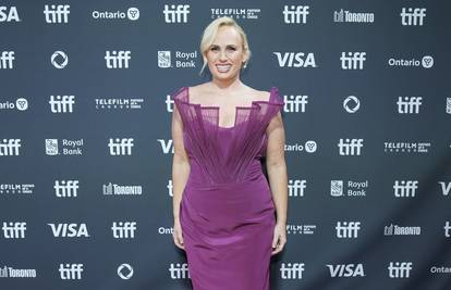 Rebel Wilson doživjela nezgodu na setu: Odmah su zvali hitnu...