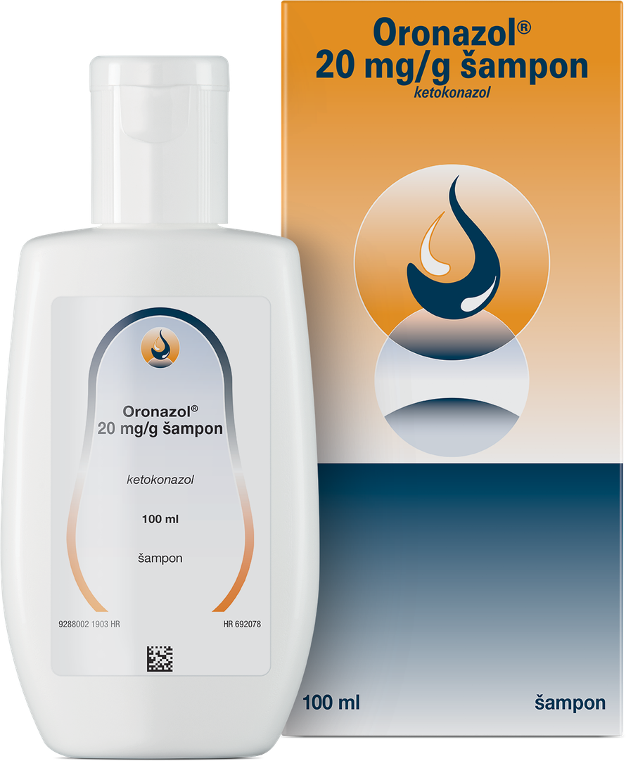 Zašto zimi imamo više problema sa peruti?