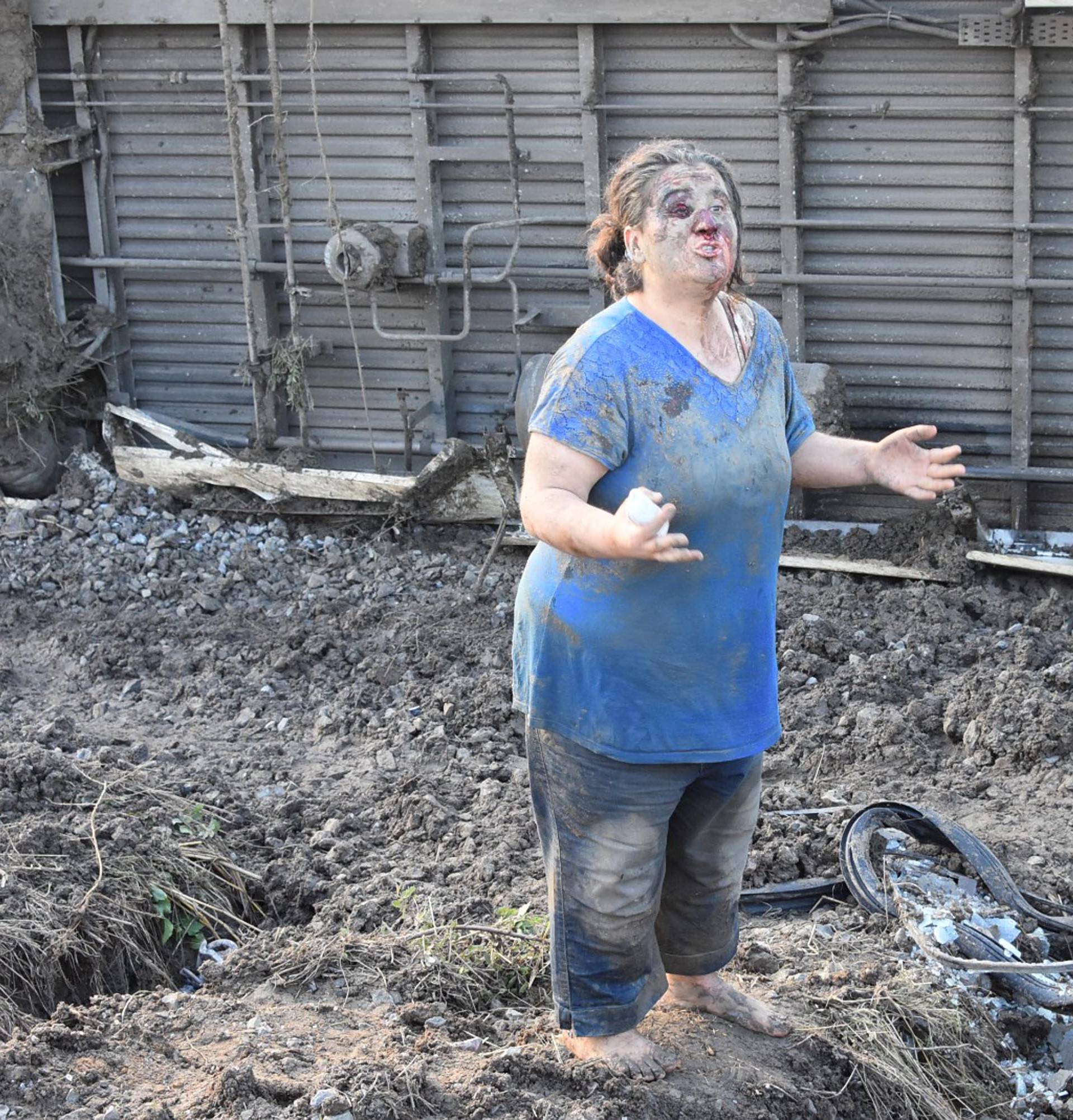 An injured woman is seen after a train came off the rails due to heavy rain and a landslide on to the tracks near Corlu in Tekirdag province