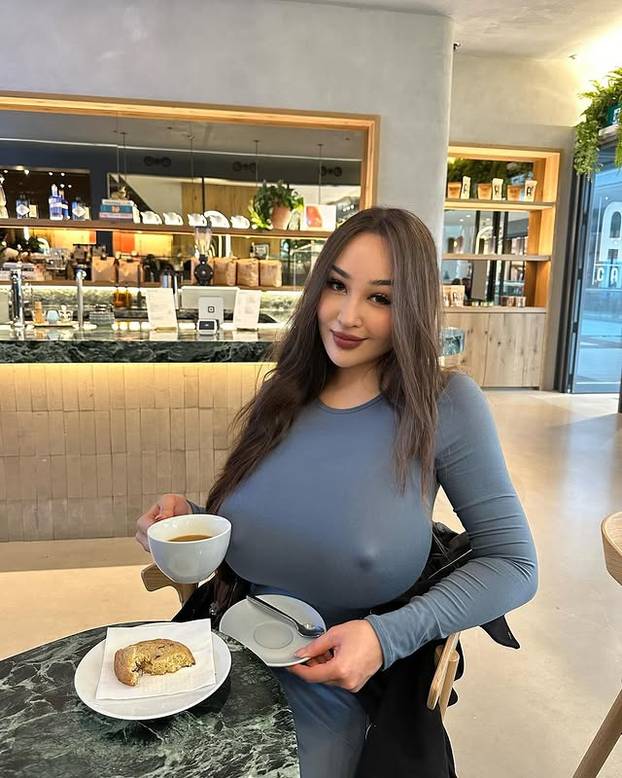 FOTO Ukrajinsku ljepoticu grudi su proslavile, a sada ih želi smanjiti: 'Svi bulje u mene'