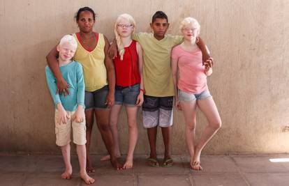 Brazilka je rodila troje albino djece: Misle da sam im dadilja