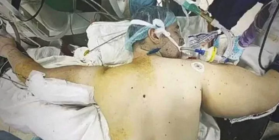 Procurio video operacije ruskog Popaja: Skoro ostao bez ruke...