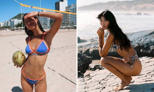 FOTO Mlada manekenka svoju 'nesigurnost' pretvorila u posao iz snova: 'To mi je najve&cacute;i adut'