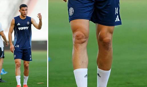 Fotka novog pojačanja Hajduka zabrinula navijače. Evo o čemu je riječ i što je s koljenom Racija