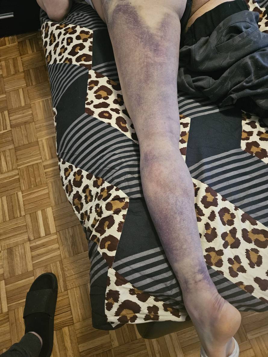 Super Silva za 24sata: Znam tko me napao, bilo je iznenada i s leđa. Jedna noga mi je uništena