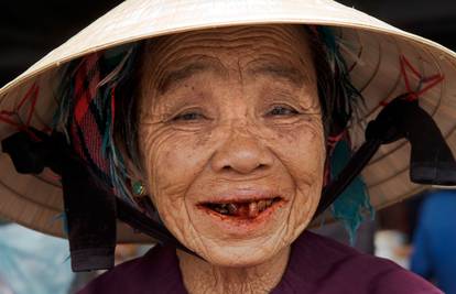 Crni osmijeh: Azijska ovisnost koja 'jede' zube i usnu šupljinu