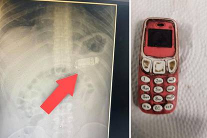 Četiri dana hodao s 'Nokijom 3310' u želucu, izvadili je bez reza: Navodno Snake još radi