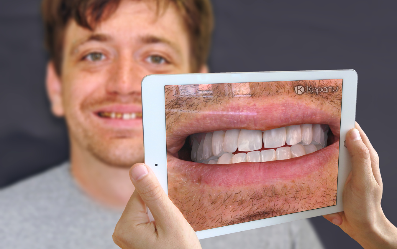 Virtualno zrcalo otkriva kako će izgledati vaš novi osmijeh