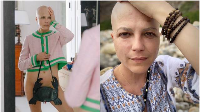 Borba s multiplom sklerozom: Blair opet šokirala fotografijom