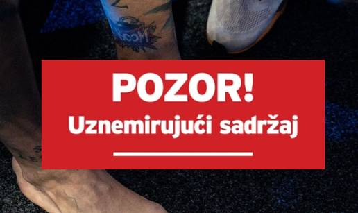 FOTO Aleksandar Ili&cacute; nokaut protiv Fabjana platio lomom noge! Pogledajte kako izgleda