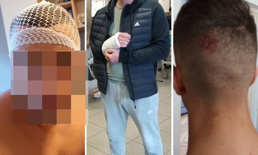 Priveli i trećeg zaštitara koji je sudjelovao u premlaćivanju mladića ispred kluba H2O