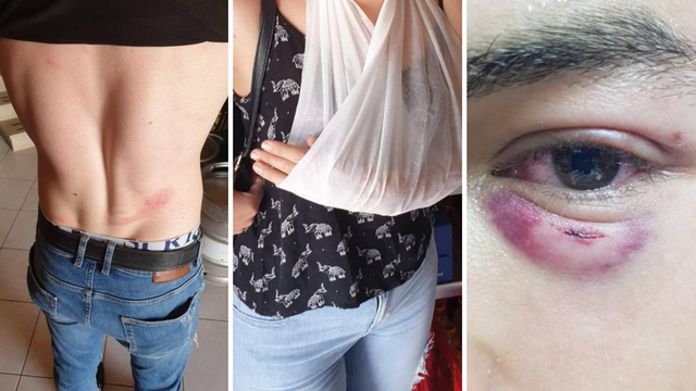 Pretukli su sezonce u Supetru: Policija uhitila trećeg napadača