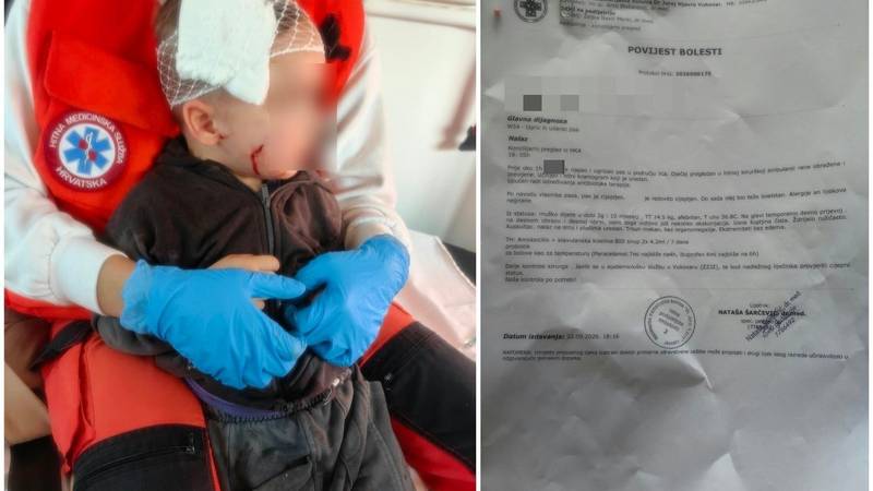 Pas napao dijete kod Vukovara: 'Sina mi je zubima uhvatio za lice! Bio je krvav, u šoku smo'