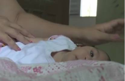 U Europi se rodila prva beba s mikrocefalijom zbog zike