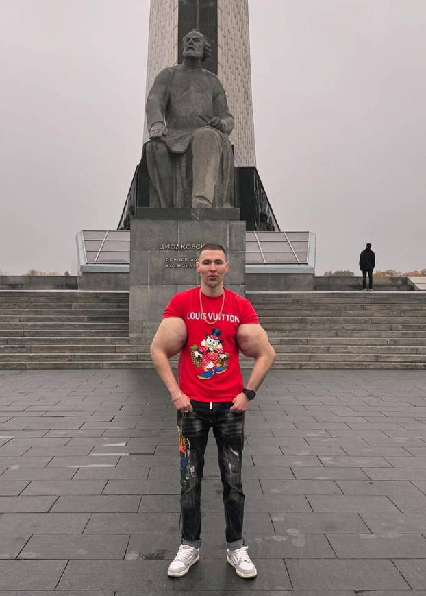 FOTO 'Ruski Popaj' mogao bi izgubiti obje ruke zbog teške infekcije: Ubrizgava kemikalije!