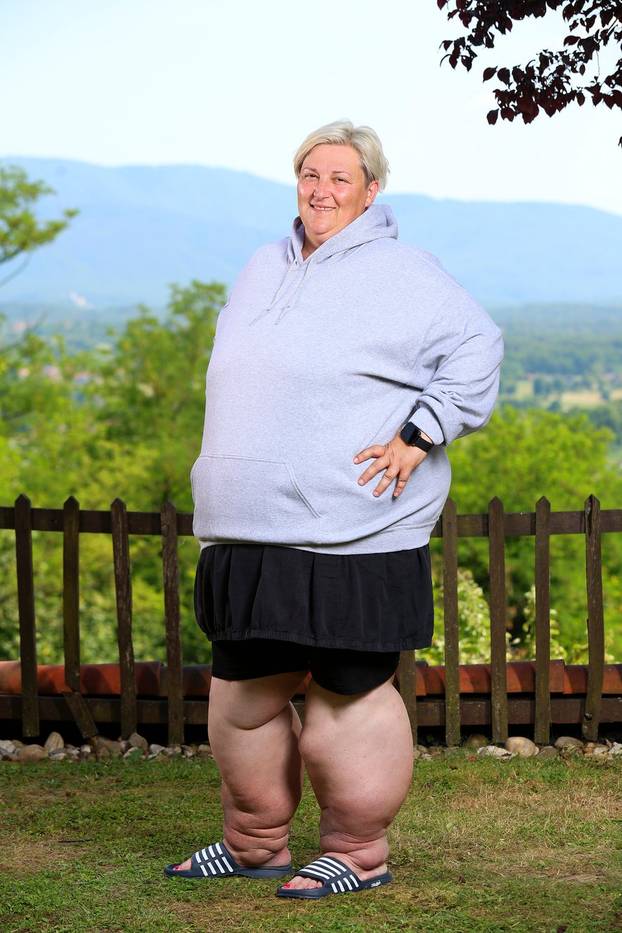 Nevjerojatne transformacije! Ovako su kandidati izgledali prije 'Života na vagi' i poslije