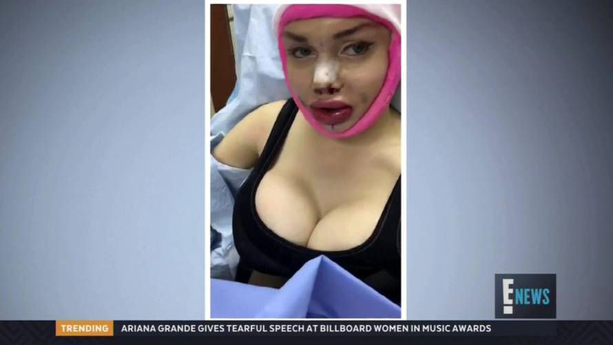 'Living Cartoon' Pixee Fox returns to Botched but docs once again refuse to operate on her