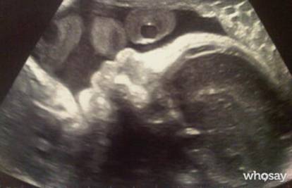Ponosni tata: Pique na Twitter stavio sinov snimak ultrazvuka