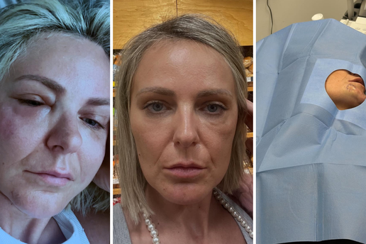 Potresno! Stankica je podijelila fotke lica: Uništili ste mi tijelo i uzeli dostojanstvo, ali živa sam
