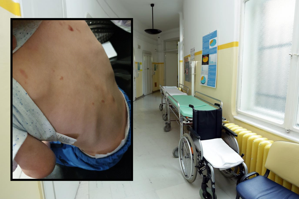U bolnicu dovela dječaka (2) s lomovima i ožiljcima od čikova