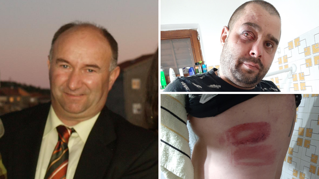 Priveden HDZ-ov donačelnik Jasenica: 'Muža su mi udarali šakama i letvom, ozlijeđen je'