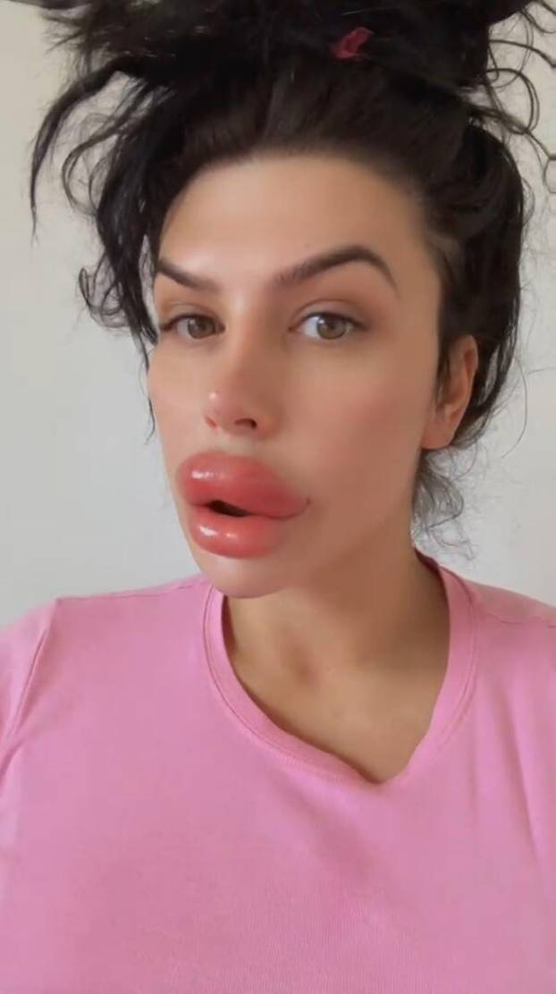 Woman with Britain's ‘biggest lips’ injects filler at HOME after being ‘refused’ by professionals – despite only taking six-week online course