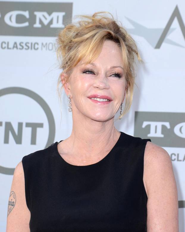 Poznata lica koja su se promijenila zbog velike koli?ine botoksa