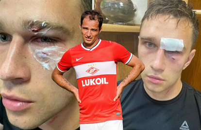 Poznati ruski nogometaš suca pogodio šakom u glavu  pa ga iscipelario nogom u rebra...