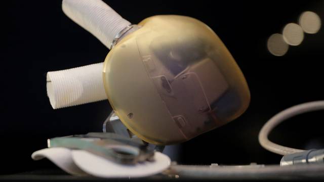 An artificial heart manufactured by French firm Carmat is seen during the company's news conference in Paris
