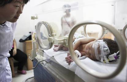 Užas: Neispravni  inkubator je doslovno spalio novorođenče