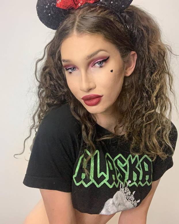 FOTO Htjela je biti žena mačka, a sad plače: Dala sam 7000 €, a fileri su me unakazili! Pomiču se