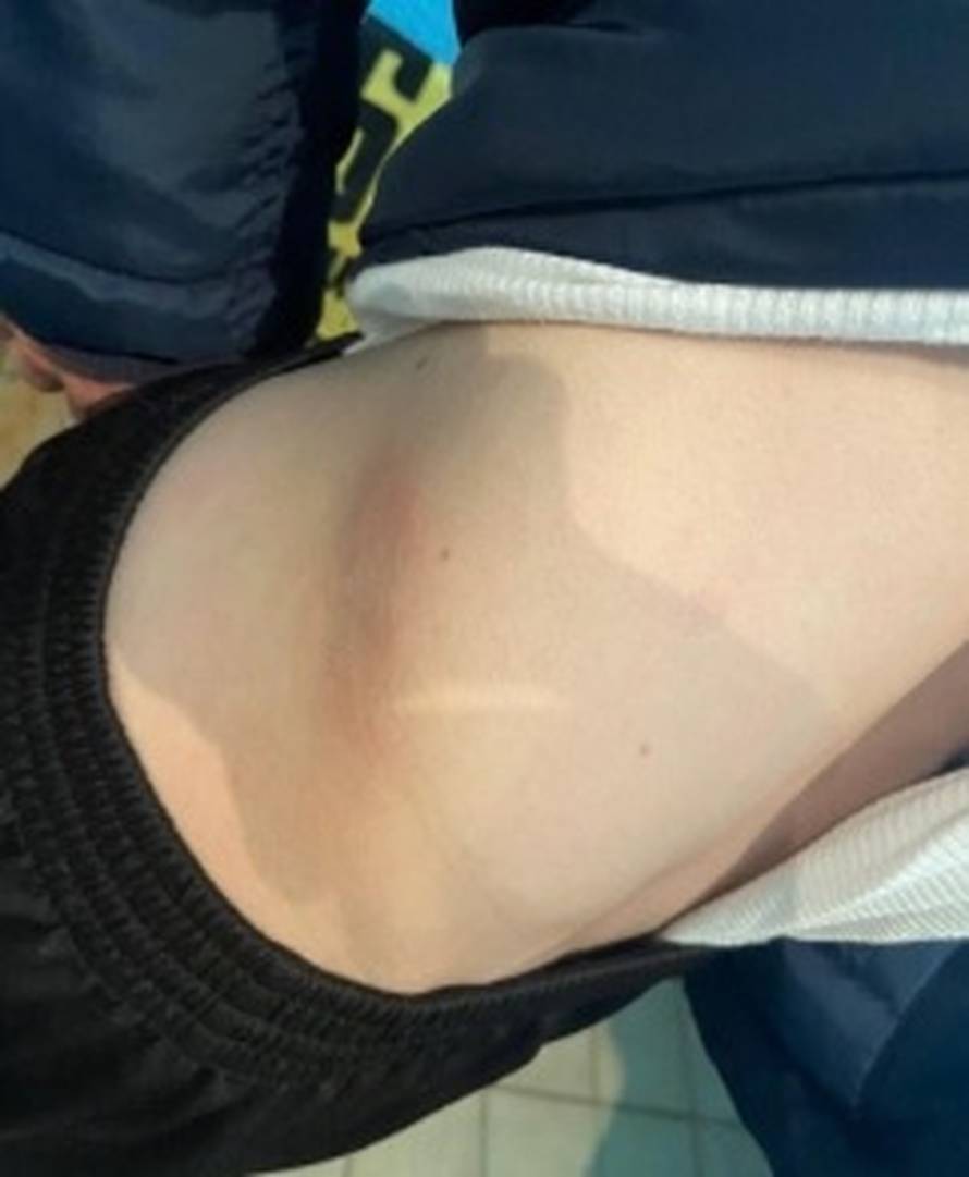 Domaćini pretukli goste jer su poveli u prvom poluvremenu: Uključili se redari i fizioterapeut