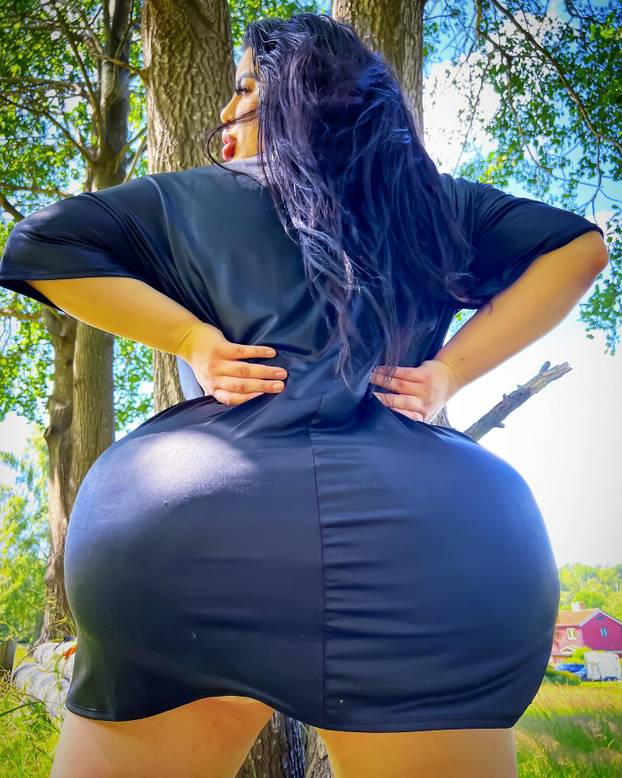 FOTO Stražnjica mi teži 45 kila, no već imam u planu sljedeću operaciju, želim imati najveću!