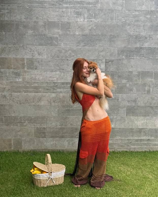 FOTO Posebna ljepota: Milijuni ljudi obožavaju njezine pjegice