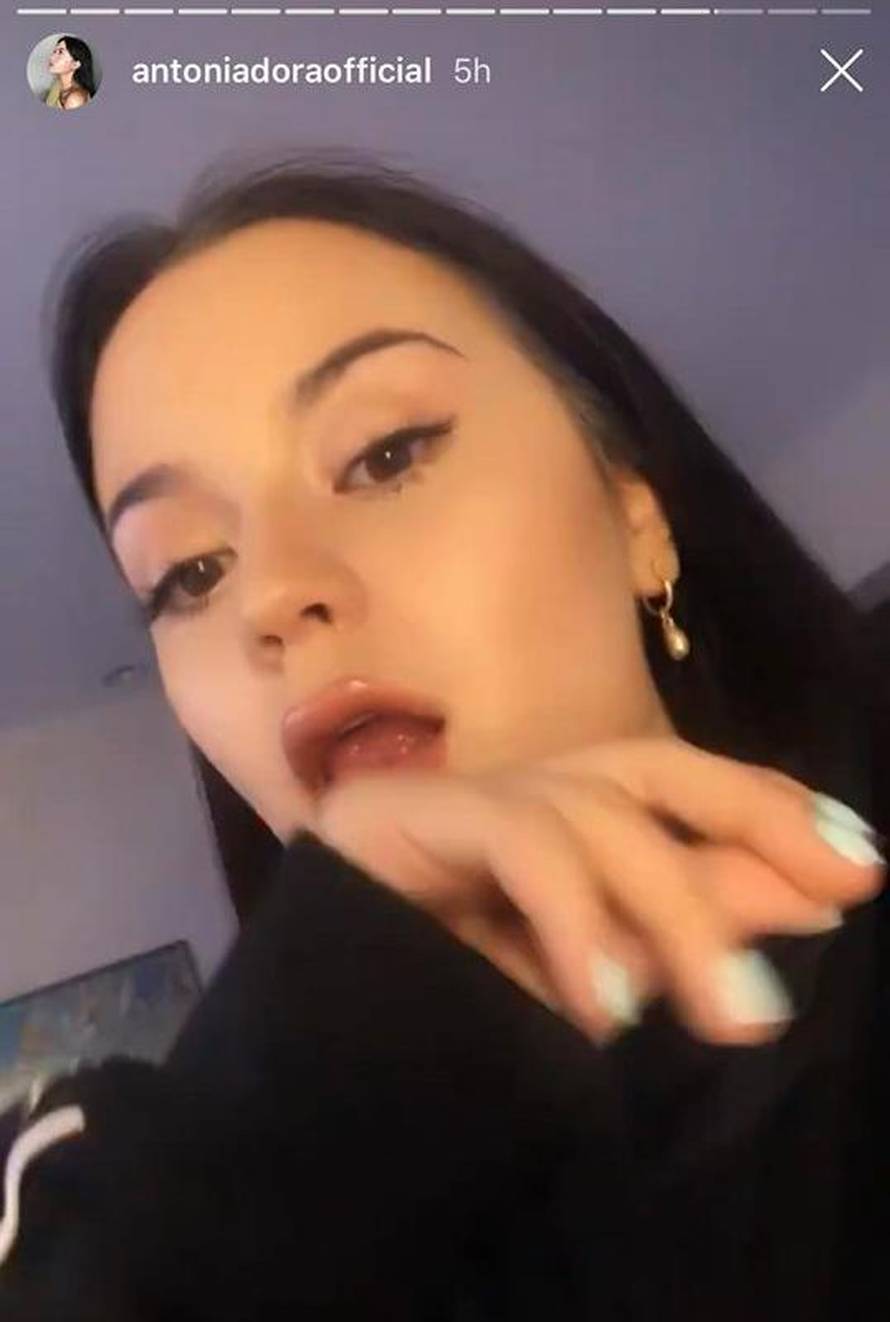 Fanovi tvrde: Povećala je usne Antonia Dora: Ma to je šminka