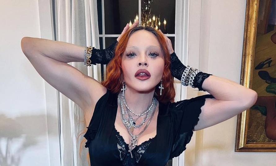 Madonna se pohvalila kako joj je splasnula oteklina na licu: 'Pogledajte kako sam slatka...'