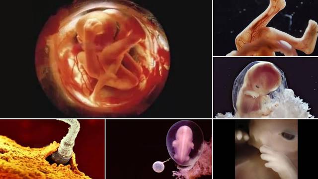 22 nevjerojatne slike razvoja čovjeka - od začeća do rođenja