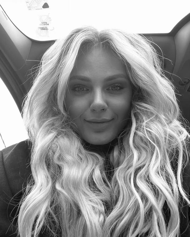 FOTO Ove slavne dame išle su pod nož: Neke su zablistale, drugima su zahvati uništili lice