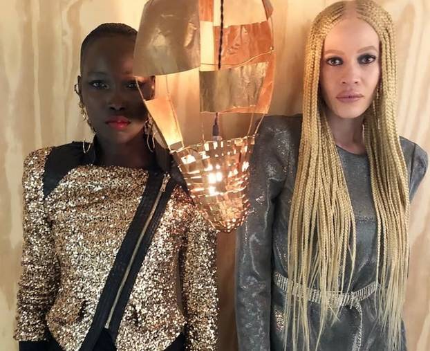 FOTO Afrikanka s albinizmom osvaja modnu industriju: 'Često privlačim znatiželjne poglede'